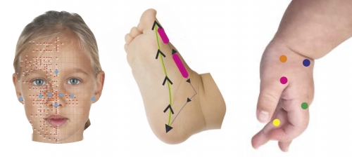 Temprana refleksna terapija sestoji iz dela na obrazu stopalih in na dlaneh