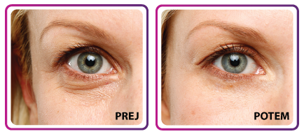 PREJ POTEM TJAŠA ŽELEZNIK OČI